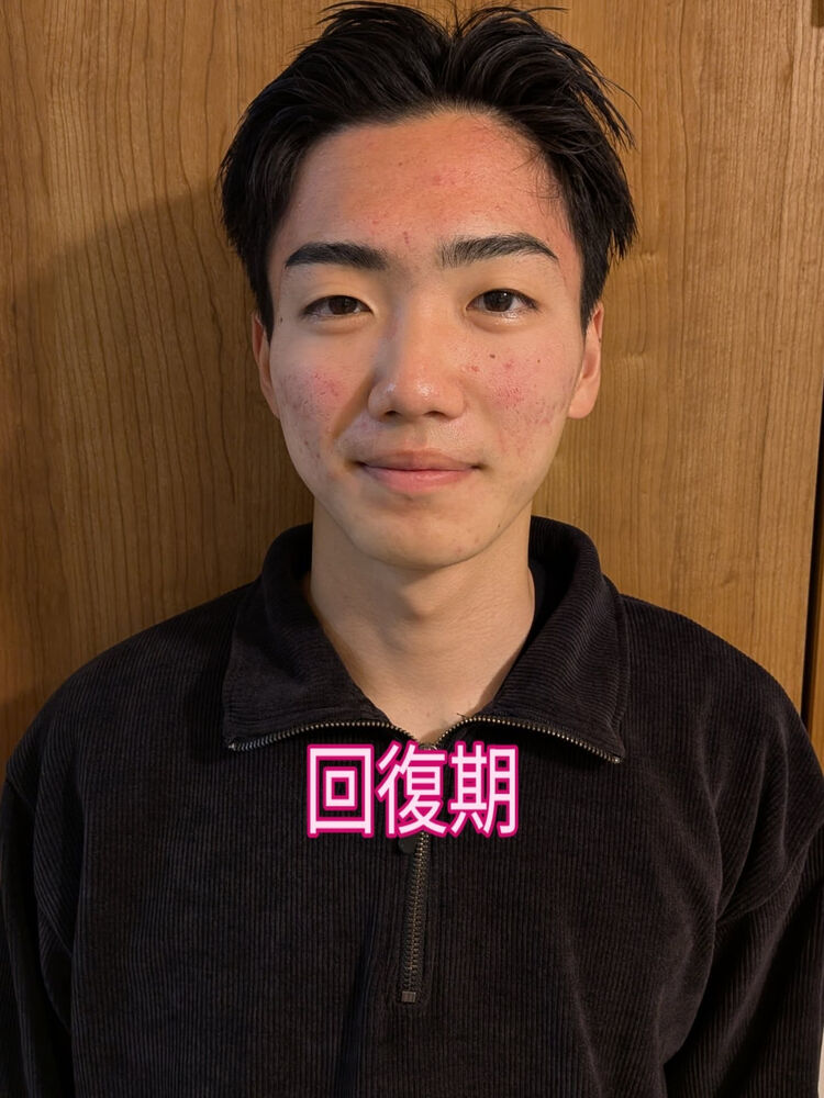 ブログ画像